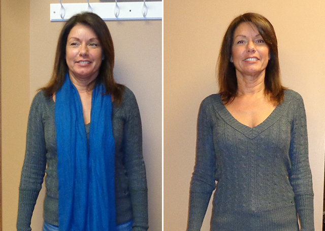 Weight Loss Testimonial Ideal You Health Center